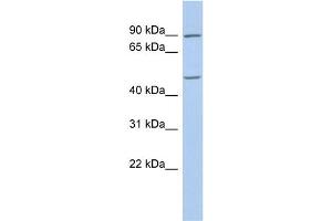 WB Suggested Anti-PLAG1 Antibody Titration:  0. (PLAG1 Antikörper  (C-Term))