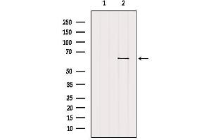 Western blot analysis of extracts from B16F10, using SLC22A6 Antibody.