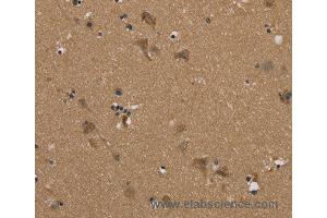 Immunohistochemistry of Human brain  using PUS10 Polyclonal Antibody at dilution of 1:45 (PUS10 Antikörper)