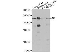 Western blot analysis of extracts of various cell lines, using PPL antibody. (PPL Antikörper)