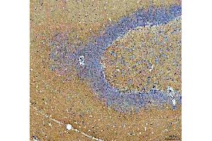 IHC analysis of Synapsin II using anti-Synapsin II antibody (ABIN4886735). (SYN2 Antikörper  (AA 497-582))