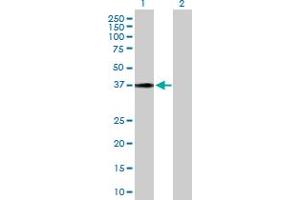 Western Blot analysis of HSD17B2 expression in transfected 293T cell line by HSD17B2 MaxPab polyclonal antibody.