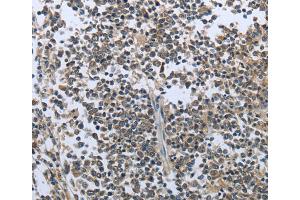 Immunohistochemistry (IHC) image for anti-Prolactin (PRL) antibody (ABIN5543735) (Prolactin Antikörper)