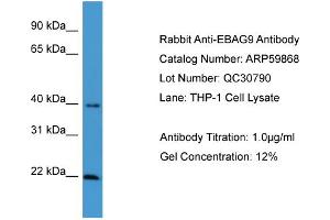 WB Suggested Anti-EBAG9  Antibody Titration: 0.