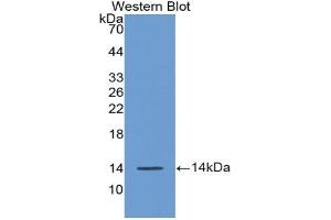Western blot analysis of the recombinant protein. (AGGF1 Antikörper  (AA 21-123))