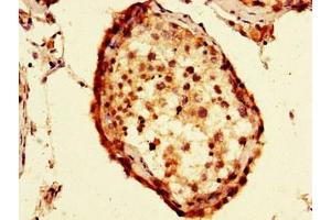 Immunohistochemistry of paraffin-embedded human testis tissue using ABIN7152582 at dilution of 1:100 (FAF1 Antikörper  (AA 490-629))