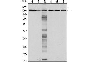 Western blot analysis using CDH1 mouse mAb against LNCAP (1),A431 (2), DU145 (3), PC-3 (4), PC-12 (5) and T47D(6) cell lysate.