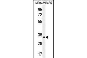 ALKBH6 Antibody (Center) (ABIN655230 and ABIN2844835) western blot analysis in MDA-M cell line lysates (35 μg/lane).