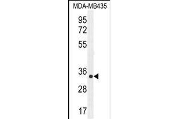 ALKBH6 Antikörper  (AA 116-145)