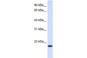 WB Suggested Anti-NKAIN1 Antibody Titration:  0. (NKAIN1 Antikörper  (Middle Region))