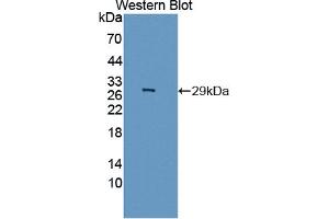Western Blotting (WB) image for anti-Nuclear Factor of kappa Light Polypeptide Gene Enhancer in B-Cells Inhibitor, epsilon (NFKBIE) (AA 115-350) antibody (ABIN5013738)