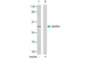 Western blot analysis of extracts from K-562 cells using GATA1 polyclonal antibody . (GATA1 Antikörper  (Ser142))