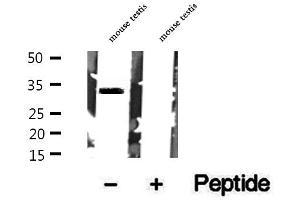 Western blot analysis of extracts of mouse testis tissue, using Syntaxin 17 antibody.