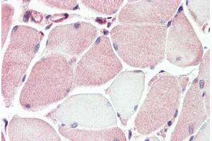 Human Skeletal Muscle (formalin-fixed, paraffin-embedded) stained with XK antibody ABIN462089 followed by biotinylated goat anti-rabbit IgG secondary antibody ABIN481713, alkaline phosphatase-streptavidin and chromogen. (Membrane transport protein XK (XK) (AA 22-38) Antikörper)