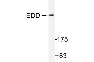 Image no. 1 for anti-Ubiquitin Protein Ligase E3 Component N-Recognin 5 (UBR5) antibody (ABIN271946) (UBR5 Antikörper)