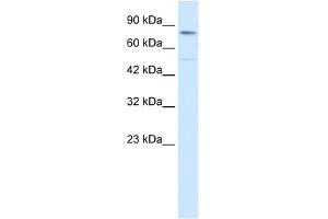 WB Suggested Anti-ZNF341 Antibody Titration: 0. (ZNF341 Antikörper  (Middle Region))