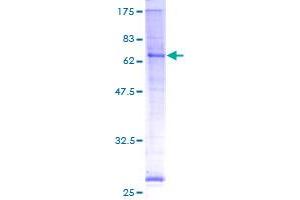 PORCN Protein (AA 1-456) (GST tag)