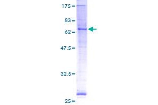 PORCN Protein (AA 1-456) (GST tag)