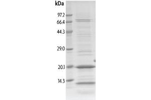 Western Blotting (WB) image for Tripartite Motif Containing 33 (TRIM33) (AA 959-1059) protein (His tag,DYKDDDDK Tag) (ABIN2669632)