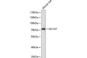 Western blot analysis of extracts of mouse eye, using SLC1 antibody (ABIN6129470, ABIN6147878, ABIN6147879 and ABIN6214419) at 1:1000 dilution. (SLC1A7 Antikörper  (AA 115-220))