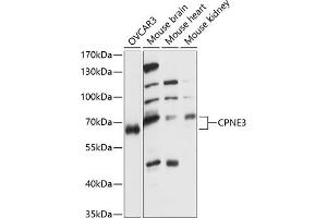 Western blot analysis of extracts of various cell lines, using CPNE3 antibody (ABIN7266500) at 1:1000 dilution. (Copine III Antikörper  (AA 238-537))