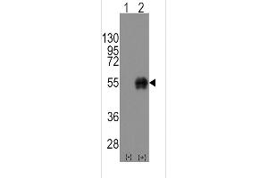 Western blot analysis of CD14(arrow) using rabbit polyclonal CD14 Antibody (C-term) (ABIN390261 and ABIN2840719). (CD14 Antikörper  (C-Term))