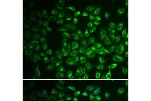 Immunofluorescence analysis of A549 cells using FABP6 Polyclonal Antibody (FABP6 Antikörper)
