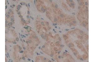 Immunohistochemistry (IHC) image for anti-Wingless-Type MMTV Integration Site Family Member 2 (WNT2) (AA 26-360) antibody (ABIN1872355)