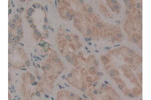 DAB staining on IHC-P; Samples: Human Kidney Tissue (WNT2 Antikörper  (AA 26-360))