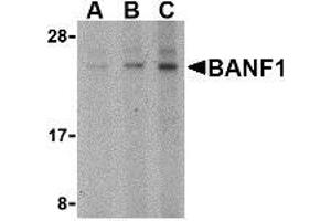 Western blot analysis of BANF1 in mouse kidney tissue lysate with AP30119PU-N BANF1 antibody at (A) 0. (BANF1 Antikörper  (N-Term))