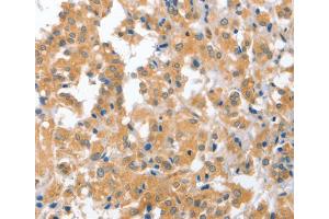 Immunohistochemistry (IHC) image for anti-Cerebellar Degeneration-Related Protein 2, 62kDa (CDR2) antibody (ABIN2423130) (CDR2 Antikörper)