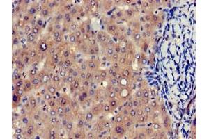 Immunohistochemistry of paraffin-embedded human liver tissue using ABIN7152188 at dilution of 1:100 (EIF4ENIF1 Antikörper  (AA 340-630))