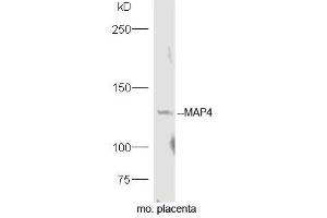 Mouse placenta lysates probed with Rabbit Anti-MAP4 Polyclonal Antibody, Unconjugated (ABIN754243) at 1:300 overnight at 4˚C. (MAP4 Antikörper  (AA 701-800))