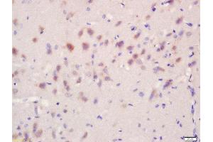 Formalin-fixed and paraffin embedded rat brain tissue labeled with Anti-Regucalcin/SMP30 Polyclonal Antibody, Unconjugated  at 1:200 followed by conjugation to the secondary antibody and DAB stainin (Regucalcin Antikörper  (AA 65-160))