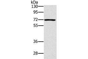 Western Blot analysis of Raji cell using PLS3 Polyclonal Antibody at dilution of 1:400 (Plastin 3 Antikörper)