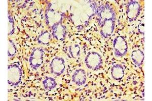 Immunohistochemistry of paraffin-embedded human small intestine tissue using ABIN7168365 at dilution of 1:100