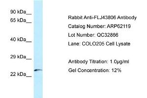 Western Blotting (WB) image for anti-Kazrin (KAZ) (N-Term) antibody (ABIN2781340) (Kazrin Antikörper  (N-Term))