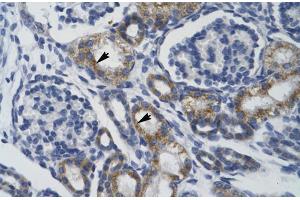 Human kidney; TRIM68 antibody - middle region in Human kidney cells using Immunohistochemistry (TRIM68 Antikörper  (Middle Region))