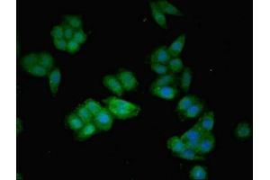 Immunofluorescent analysis of HepG2 cells using ABIN7144136 at dilution of 1:100 and Alexa Fluor 488-congugated AffiniPure Goat Anti-Rabbit IgG(H+L) (AGT Antikörper  (AA 44-427))