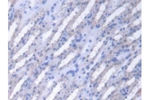 Detection of FUM in Mouse Kidney Tissue using Polyclonal Antibody to Fumarase (FUM) (FH Antikörper  (AA 42-185))