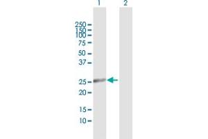 Western Blot analysis of DCI expression in transfected 293T cell line by DCI MaxPab polyclonal antibody. (DCI Antikörper  (AA 1-243))