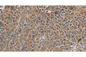 Immunohistochemistry (Paraffin-embedded Sections) (IHC (p)) image for anti-NADH Dehydrogenase (Ubiquinone) Fe-S Protein 7, 20kDa (NADH-Coenzyme Q Reductase) (NDUFS7) antibody (ABIN7237508)