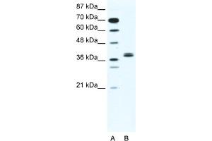 WB Suggested Anti-BHLHB5 Antibody   Titration: 2. (BHLHE22 Antikörper  (N-Term))