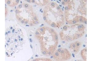 DAB staining on IHC-P; Samples: Human Kidney Tissue (ADAM9 Antikörper  (AA 440-680))