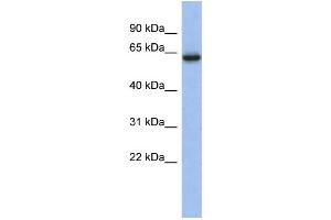 WB Suggested Anti-CACNB2 Antibody Titration:  0. (CACNB2 Antikörper  (Middle Region))