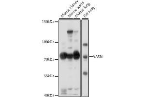 Western blot analysis of extracts of various cell lines, using VASN antibody (ABIN7271301) at 1:1000 dilution. (Vasn Antikörper  (AA 420-575))