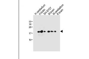 All lanes : Anti-FXYD6 Antibody (C-term) at 1:1000 dilution Lane 1: Human cerebellum tissue lysate Lane 2: Human brain tissue lysate Lane 3: SH-SY5Y whole cell lysate Lane 4: Mouse brain tissue lysate Lane 5: Mouse cerebellum tissue lysate Lane 6: Rat brain tissue lysate Lysates/proteins at 20 μg per lane. (FXYD6 Antikörper  (C-Term))