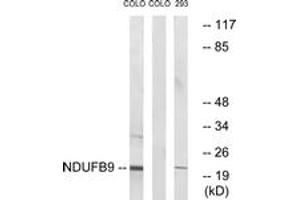Western Blotting (WB) image for anti-NADH Dehydrogenase (Ubiquinone) 1 beta Subcomplex, 9, 22kDa (NDUFB9) (AA 102-151) antibody (ABIN1535062)