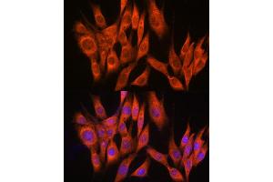 Immunofluorescence (IF) image for anti-Protein Phosphatase, Mg2+/Mn2+ Dependent, 1A (PPM1A) (AA 1-382) antibody (ABIN6146039)