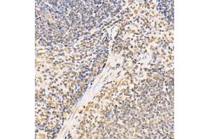 Immunohistochemistry of paraffin-embedded mouse spleen using SS18 Rabbit pAb (ABIN6133185, ABIN6148473, ABIN6148474 and ABIN6222754) at dilution of 1:100 (40x lens). (SS18 Antikörper  (AA 1-240))